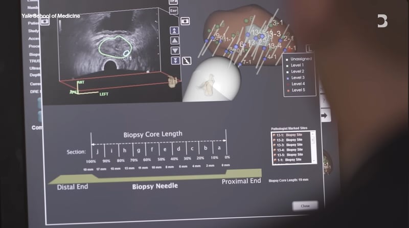 ouTube video screenshot showing the use of AI to analyse cardiovascular scans 